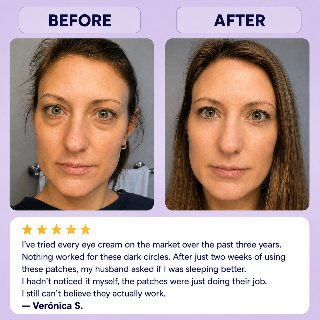 Eye Patches | Hialuronic acid, Peptides and Collagen